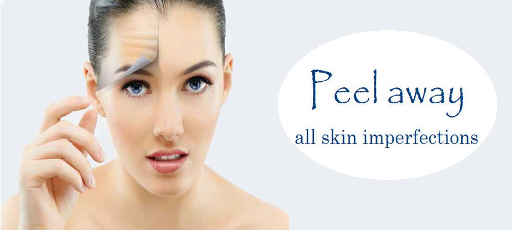 Chemical Peels Fairfax