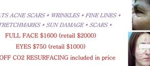 Fractional CO2 Laser