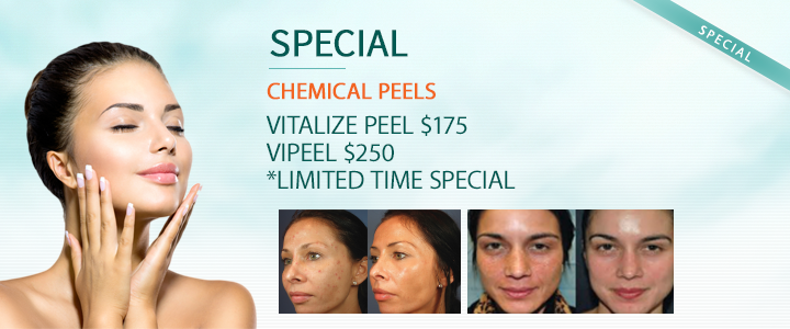 Peels Fairfax Va