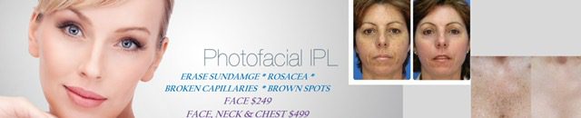 Photo facial Fairfax VA